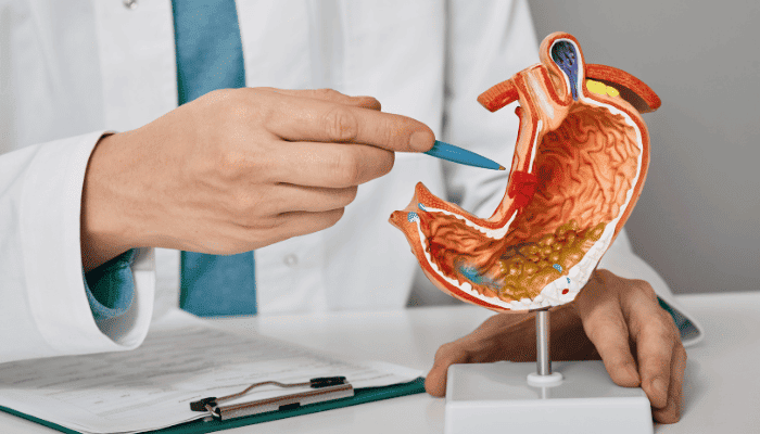 بایپس معده؛ کاهش وزن ماندگار